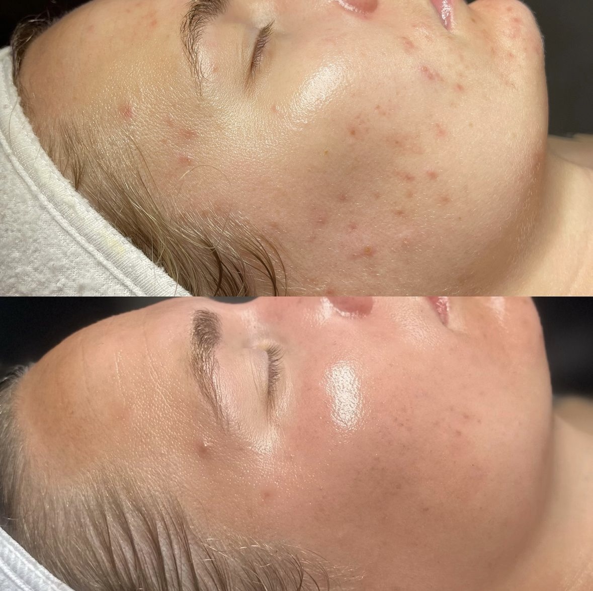 Client before and after