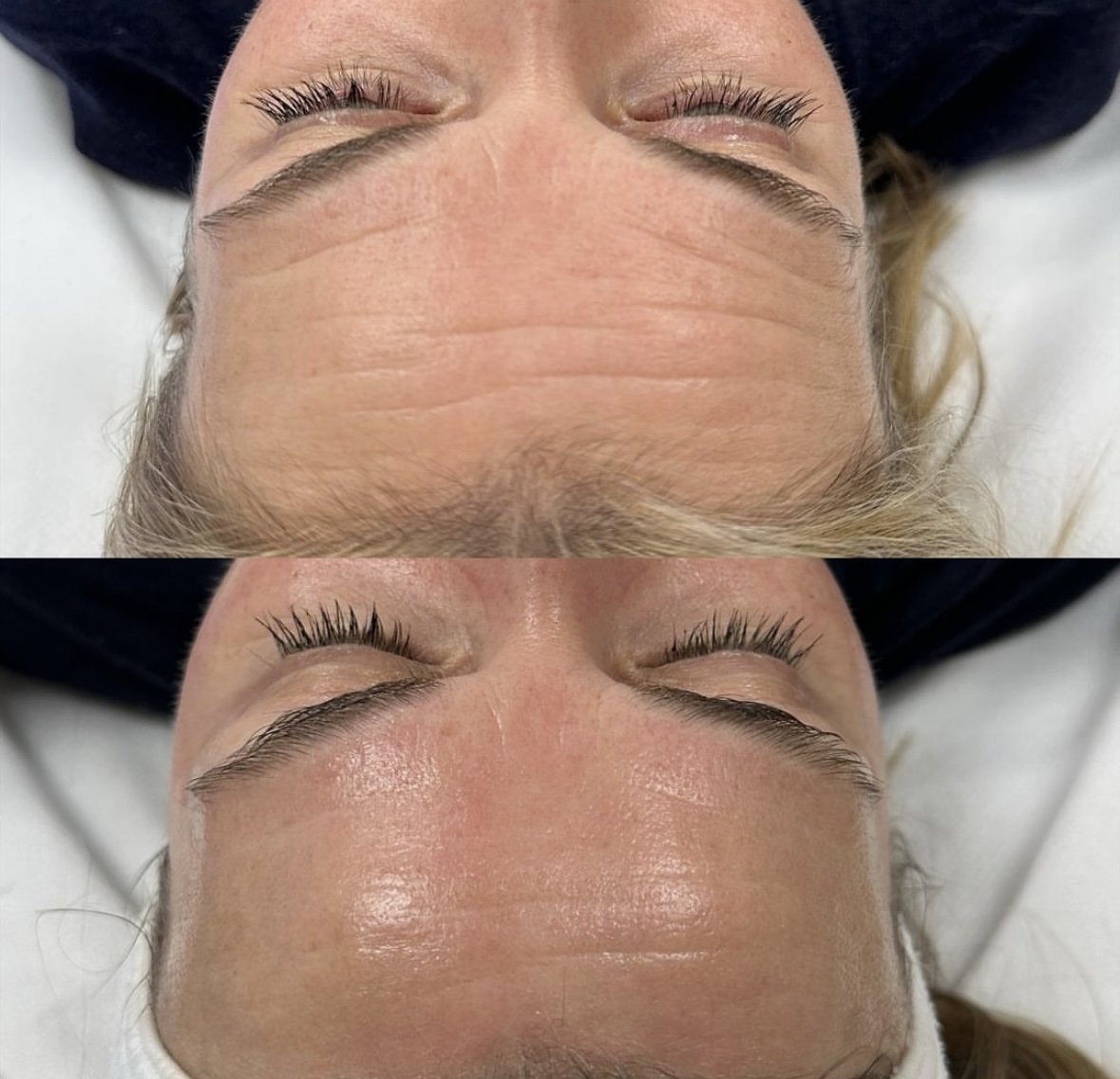 Client before and after