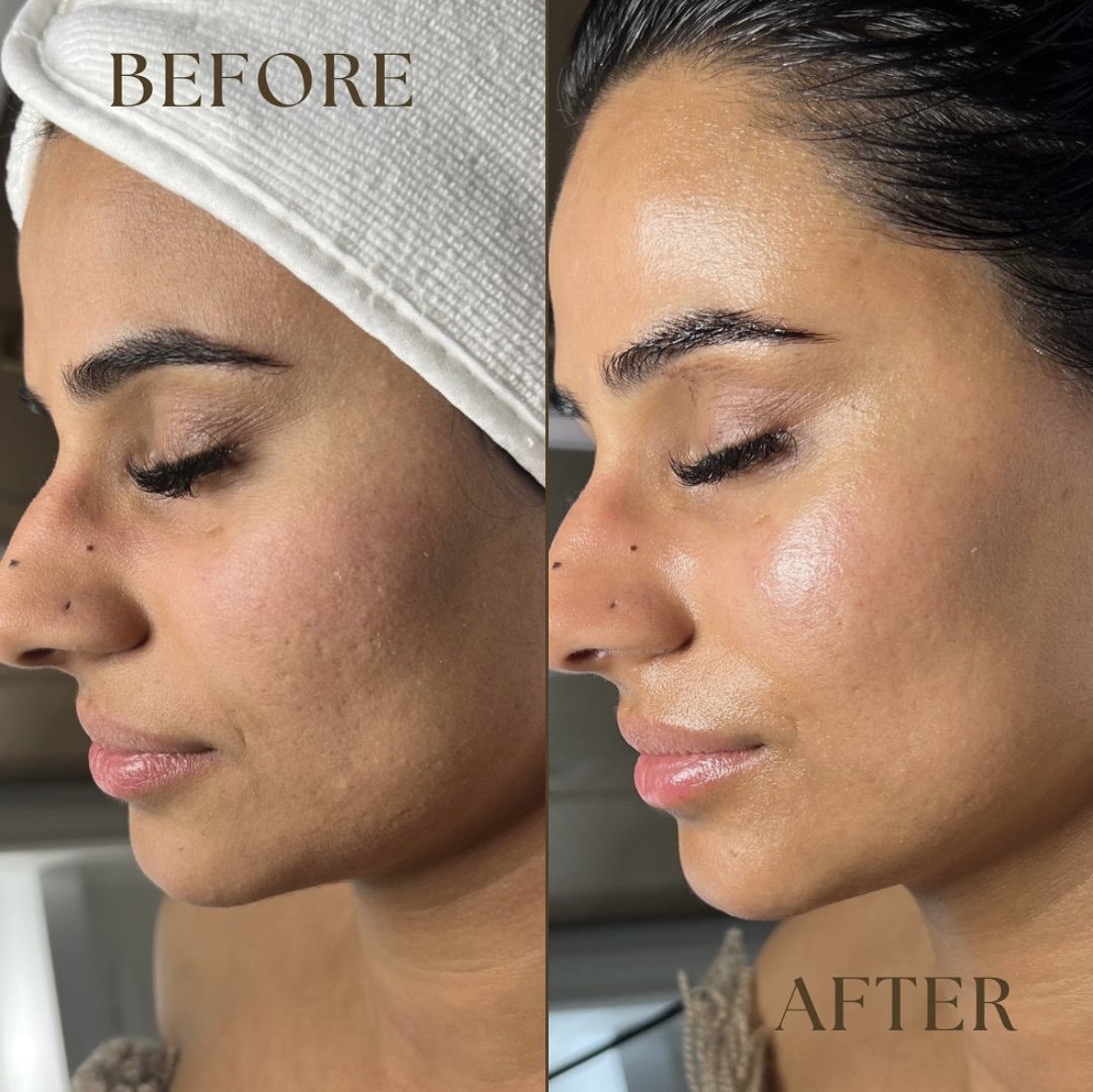 Client before and after